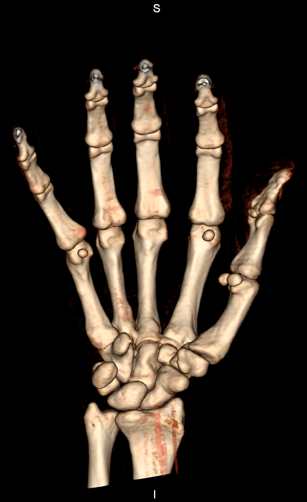 3D MÃO FRONTAL