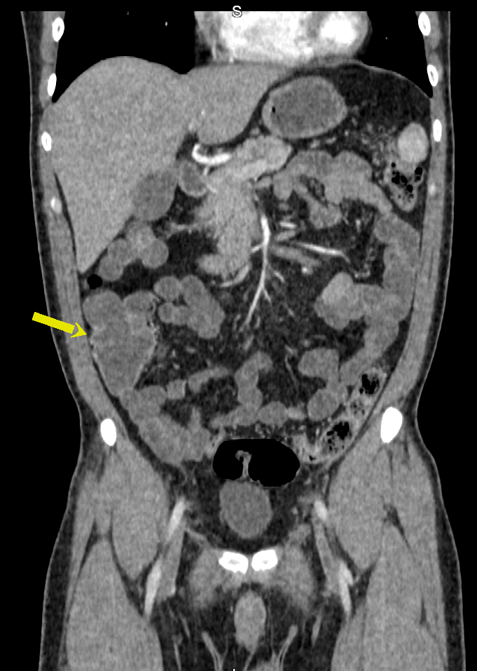 FASE ARTERIAL C-C